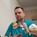 Sukurtas pirmas rankos protezas, perduodantis lytėjimo jausmą