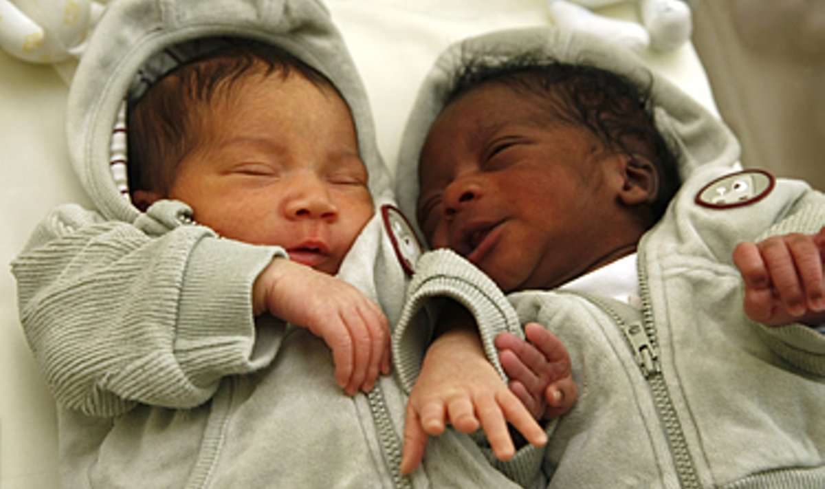 Vokietijoje juodaodžiui ir baltaodei gimė skirtingų odos spalvų dvynukai. 