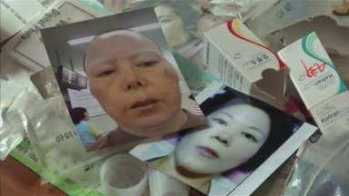 Pietų Korėjoje daugėja nekvalifikuotų plastikos chirurgų aukų