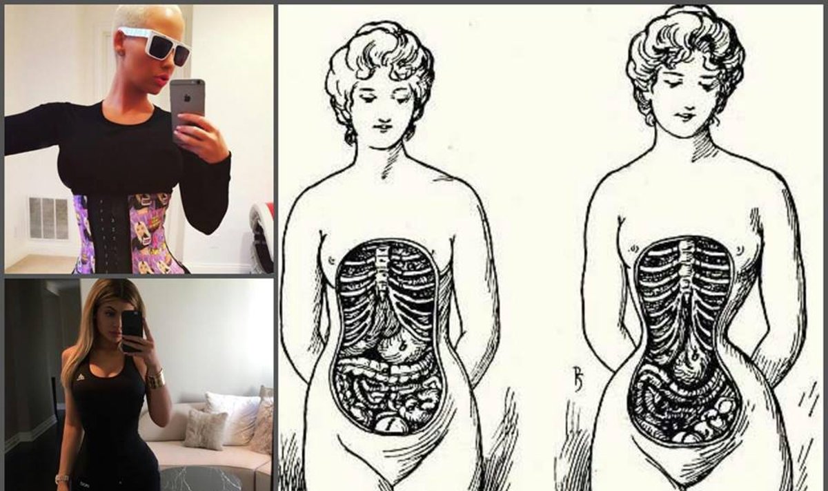 Internete plintanti nuotrauka, kuri parodo, kas moters kūne įvyksta nešiojant korsetą