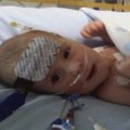 Po širdies operacijos komplikacijų medikai 4 dienoms „užšaldė“ kūdikį