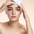 Priešmenstruacinis sindromas: kas lemia veido odos būklę ir kodėl to nereikėtų ignoruoti?