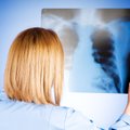 Vėžiniai dariniai plaučiuose randami ir visiškai atsitiktinai