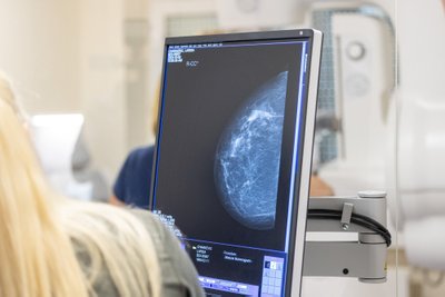 Santaros klinikose atidarytas naujas Krūtų radiologinės diagnostikos poskyris
