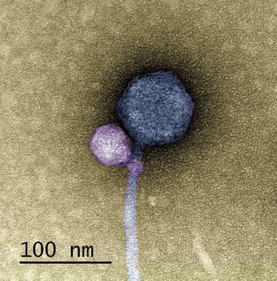 Užfiksuotame mikroskopiniame vaizde matyti, jog mažesnysis (pavaizduotas violetine spalva), yra satelitinis virusas, t. y. virusas, kuris negali užkrėsti ir daugintis šeimininko (bakterijos, pavyzdžiui, lot. Streptomyces) ląstelėse be taip vadinamo „pagalbinio“ viruso, pavaizduoto mėlyna spalva.Tagide deCarvalho nuotr.