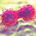 Kviečia išsitirti dėl 4 rūšių vėžio bei širdies ir kraujagyslių ligų: išvardijo, kam tyrimai nemokami
