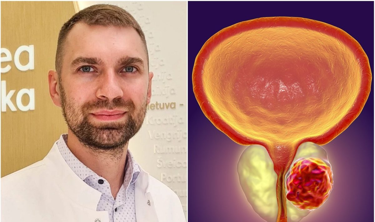 Urologas išvardijo simptomus, kurie gali byloti apie inkstų ar ...