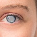 Oftalmologė – apie nepagydomą akių ligą, kuria suserga net ir jauni: dėl lemiamų klaidų negrįžtamai apankama