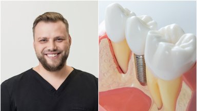 Gydytojas papasakojo, kada dantų protezavimas tampa žymiai paprastesnis ir sumažėja komplikacijų tikimybė