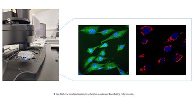Baltymų lokalizacijos ląstelėse tyrimai, naudojant konfokalinę mikroskopiją. VU GMC archyvo nuotr.