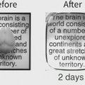 Stanfordo mokslininkai išgavo skaidrų pelės smegenų vaizdą