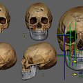Prieš 500 metų gyvenusios moters veidą sudarkė šiurpi infekcija: kaukolę rekonstravę mokslininkai atkūrė, kaip ji atrodė