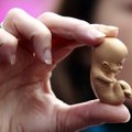 Tūkstančiai airių proteste reikalavo pakeisti abortų įstatymą