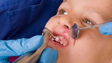 Kai kuriems vaikams dantys pradeda gesti anksčiau, o ėduonis pasireiškia dažniau: kas tai lemia?