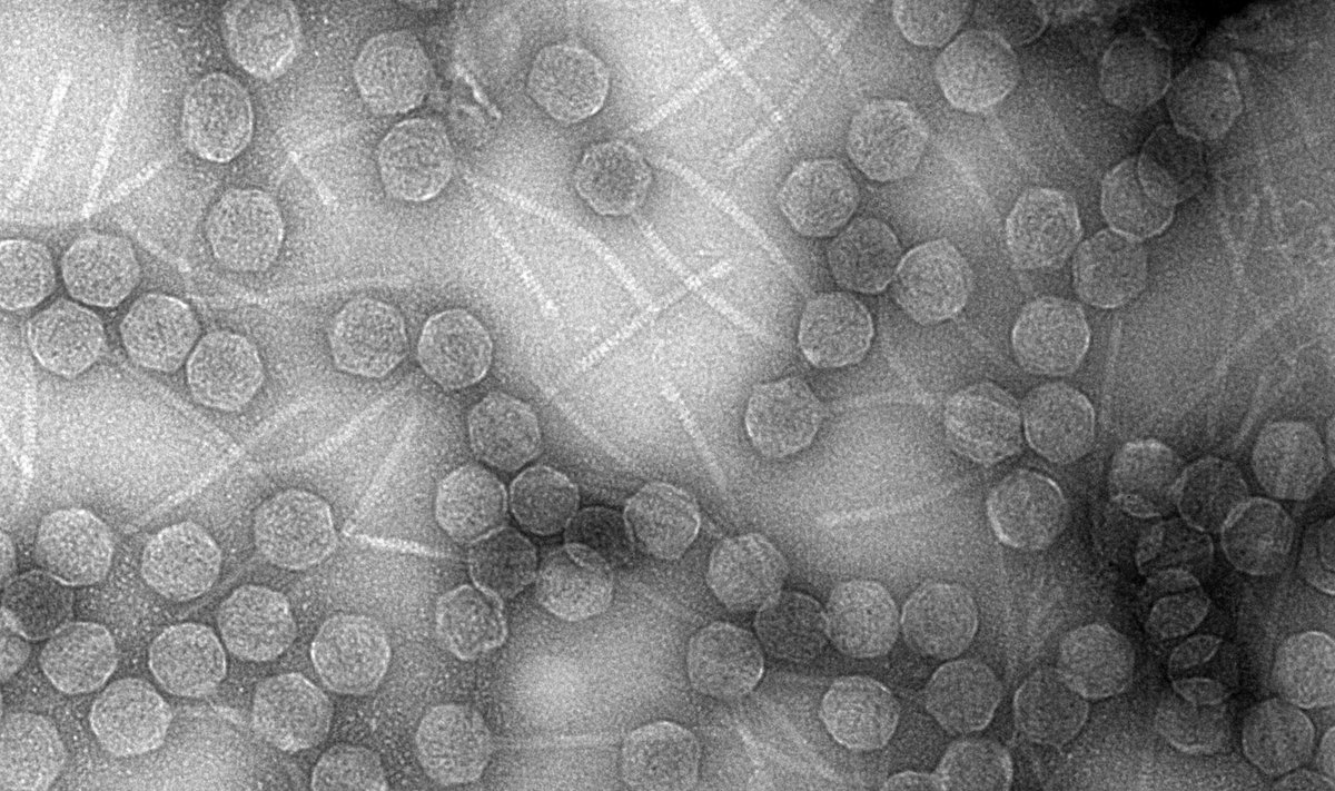 E. coli bakteriją infekuojantys virusai
