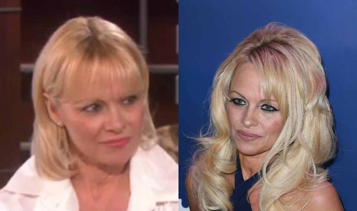 Pamela Anderson dabar (kairėje) ir vasario mėnesį