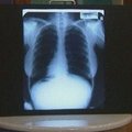 Trys M.Monroe rentgenogramos parduotos už 45 tūkst. dolerių
