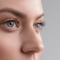 Plastinė nosies operacija: kokiais atvejais ji atliekama ir ko tikėtis