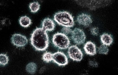 Austrijos mokslininkai tikina išsiaiškinę, kodėl kai kurie persirgę COVID-19 neturi imuniteto.