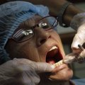 Mokslininkai sugalvojo visiškai beskausmį dantų taisymo būdą