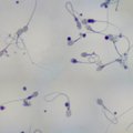 Viltis nevaisingiems vyrams – mokslininkai augina spermą iš odos