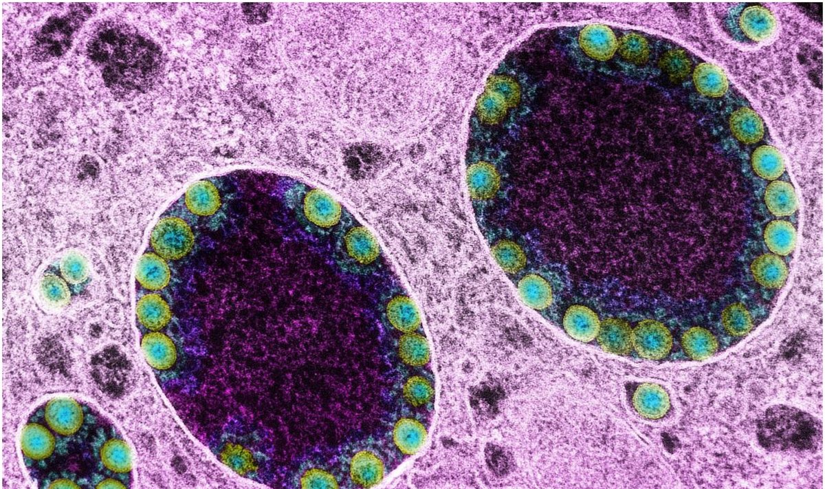 Atrastos dar kelios į SARS-COV-2 panašios virusų rūšys, kurias platina šikšnosparniai. NIH nuotr.