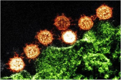 Atrastos dar kelios į SARS-COV-2 panašios virusų rūšys, kurias platina šikšnosparniai. NIH nuotr.