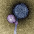 Pro mikroskopą pirmą kartą tokį vaizdą pamatę mokslininkai nepatikėjo savo akimis: virusas prisisiurbė prie kito viruso, liko net žymės
