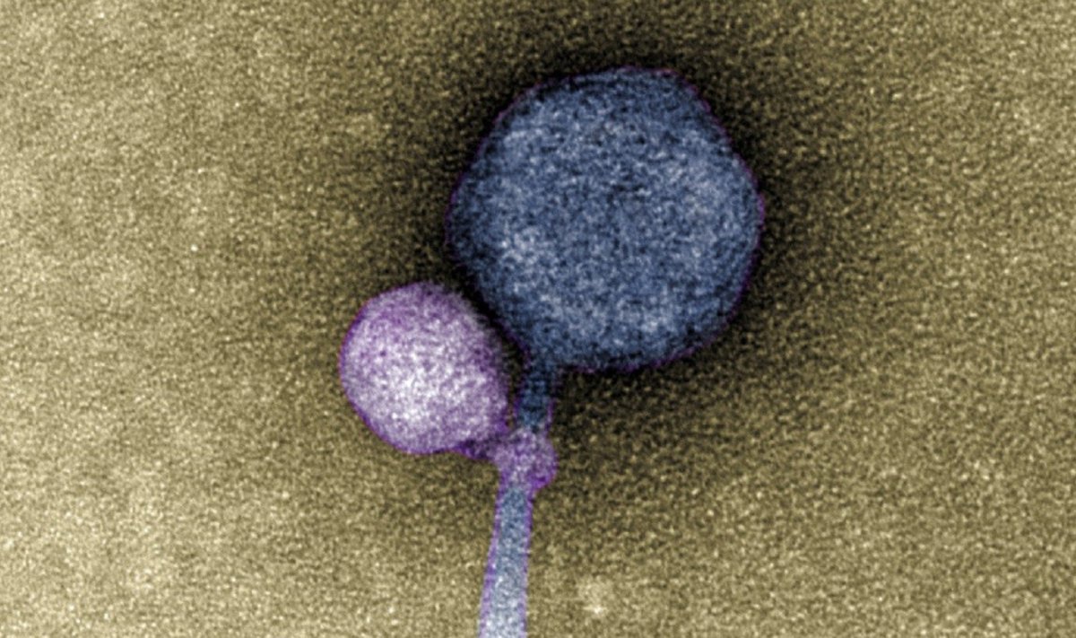 Užfiksuotame mikroskopiniame vaizde matyti, jog mažesnysis (pavaizduotas violetine spalva), yra satelitinis virusas, t. y. virusas, kuris negali užkrėsti ir daugintis šeimininko (bakterijos, pavyzdžiui, lot. Streptomyces) ląstelėse be taip vadinamo „pagalbinio“ viruso, pavaizduoto mėlyna spalva.Tagide deCarvalho nuotr.