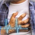 Kalėdų išvakarėse gydytojams nerimą kelia „šventinis širdies sindromas“: papasakojo, kas jį sukelia