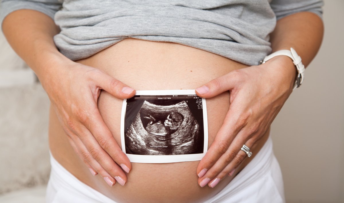 nėštumas, nėščioji, nėščia, ultragarsas, echoskopija, vaisiaus nuotrauka