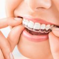Pamirškite breketus: populiarėja nematoma dantų tiesinimo technologija