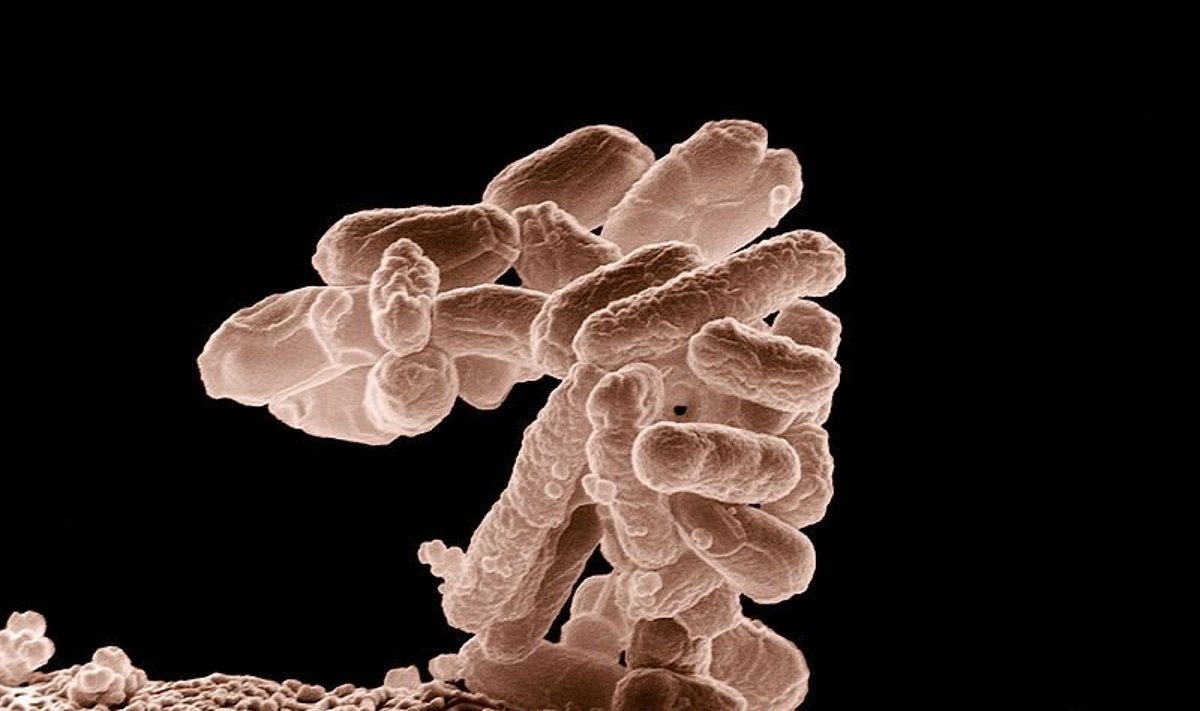 Asociatyvi nuotr. / Vienaląstė E.coli bakterija