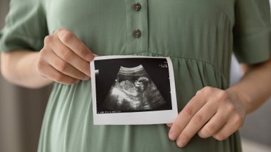 Galite tikėti arba ne: tikina, kad kūdikio lytį galima nustatyti gerokai anksčiau, nei pamato gydytojai
