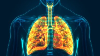 Tyli ir sunki plaučių liga: laiku nediagnozavus gali tekti net persodinti širdį