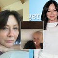 Shannen Doherty parodė kovą su paskutinę stadiją pasiekusiu vėžiu: tai neatrodo gražiai, bet tokia realybė