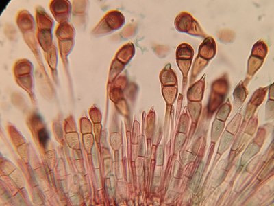 Ant augalų ląstelių augantys grybai po mikroskopu 
