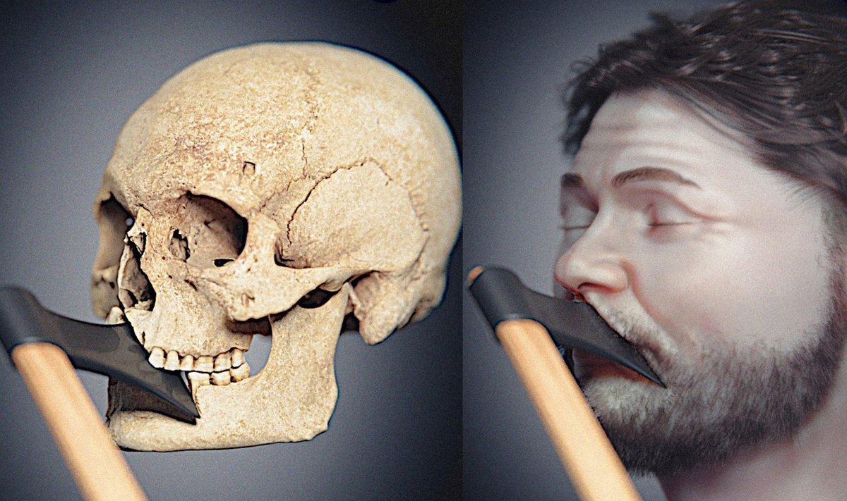 Viduramžių laikų kaukolės veido rekonstrukcija rodo, kad žuvusiajam mūšyje veikiausiai buvo suduotas mirtinas smūgis kirviu. Cícero Moraes/Thiago Beaini/Thomas Hvashoj Steffensen/Michel Dalstra iliustr.