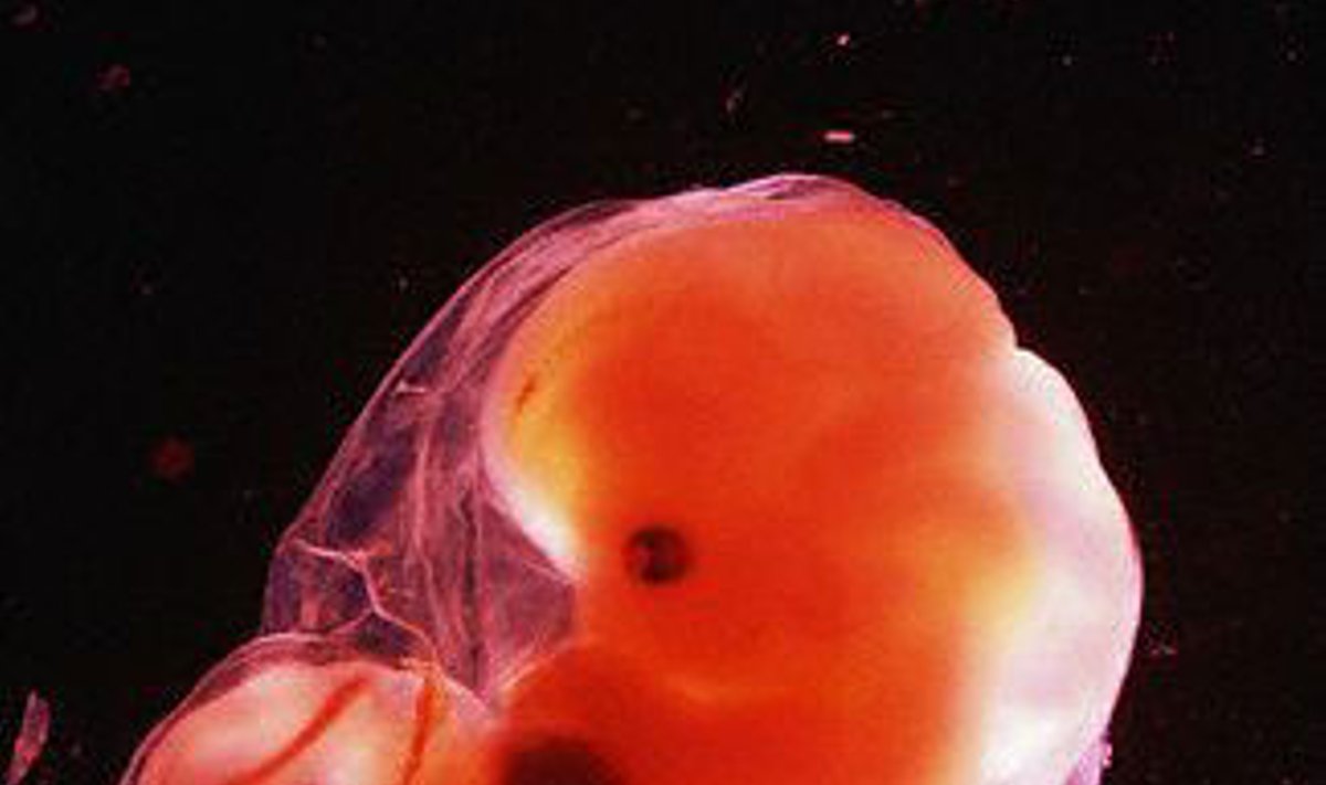 Žmogaus embrionas