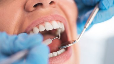10 požymių, kurie rodo, kad jūsų dantys genda