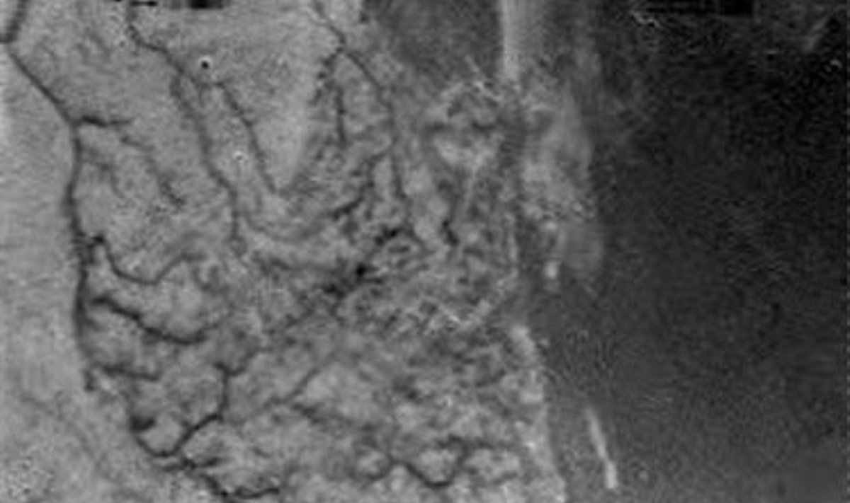 Zondu "Huygens" perduotas vienas pirmųjų Titano paviršiaus vaizdų