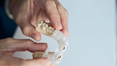 Dar mažai kas girdėjo apie šį dantų implantavimo būdą: padeda išvengti daugybės problemų