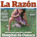 Meksikai gėdą užtraukusi nuotrauka – moteris pagimdė ant ligoninės vejos
