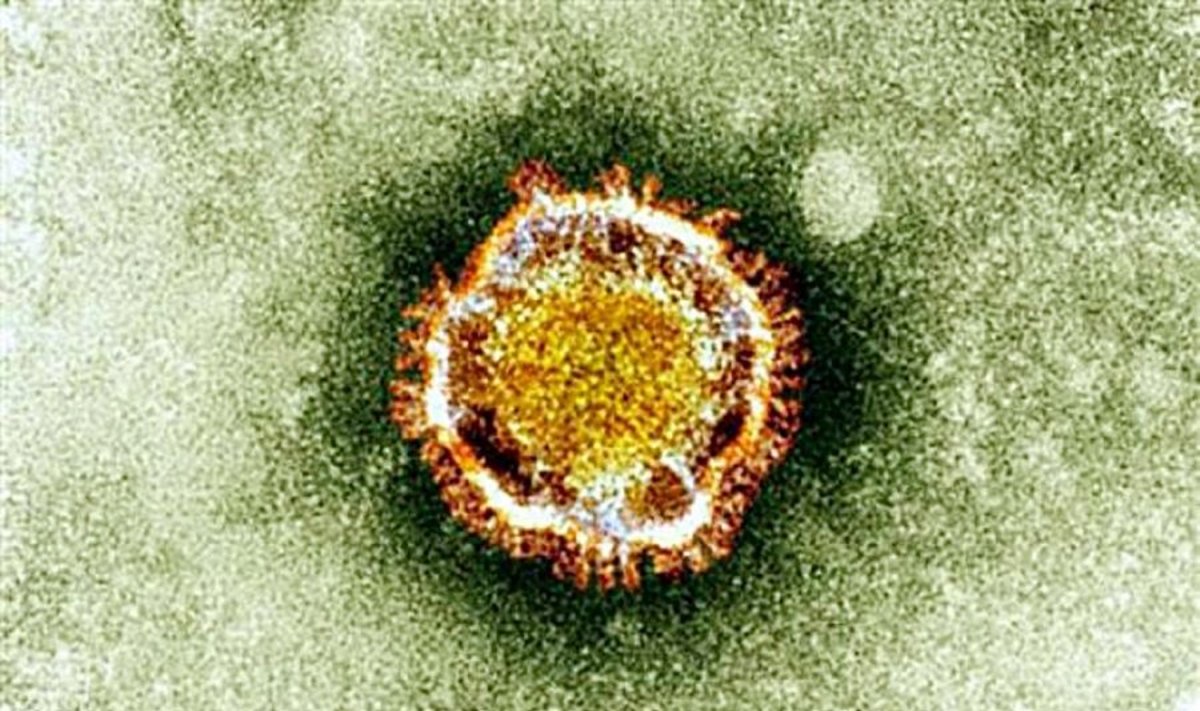 Elektroniniu mikroskopu užfiksuotas koronaviruso vaizdas