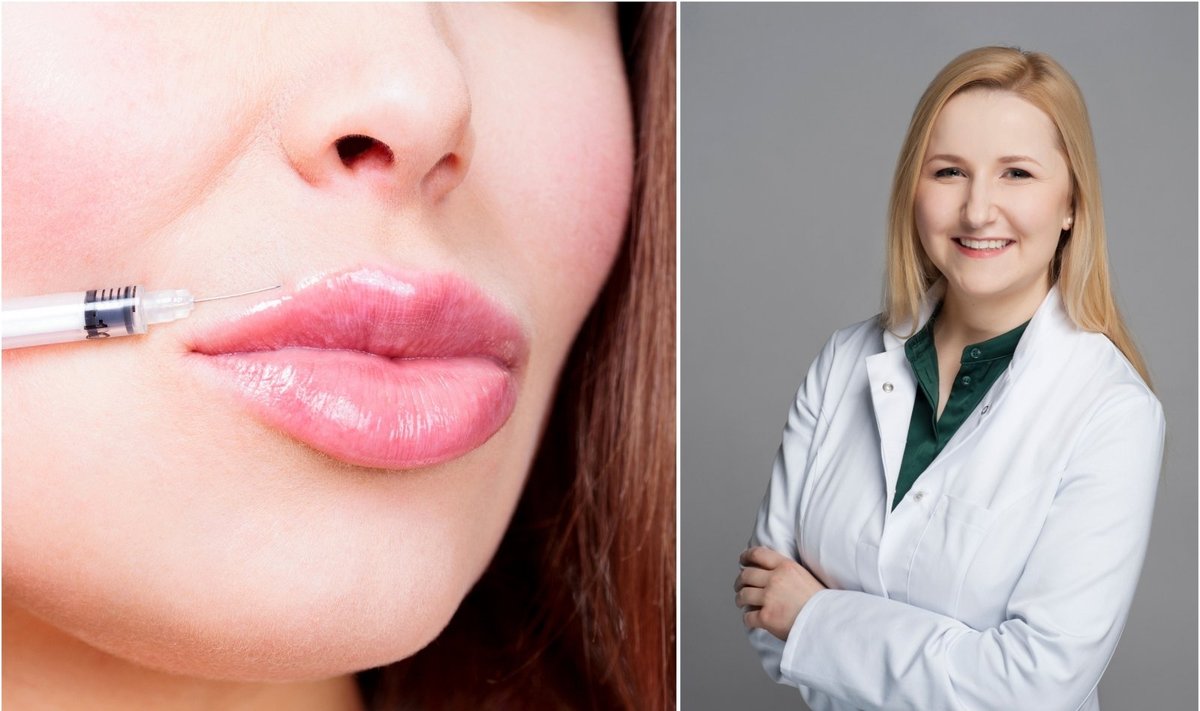 Gydytoja Aistė Audickaitė įspėjo dėl netinkamai atliekamų grožio injekcijų