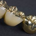 Krematoriumo darbuotojai nuolat vogė auksinius dantis