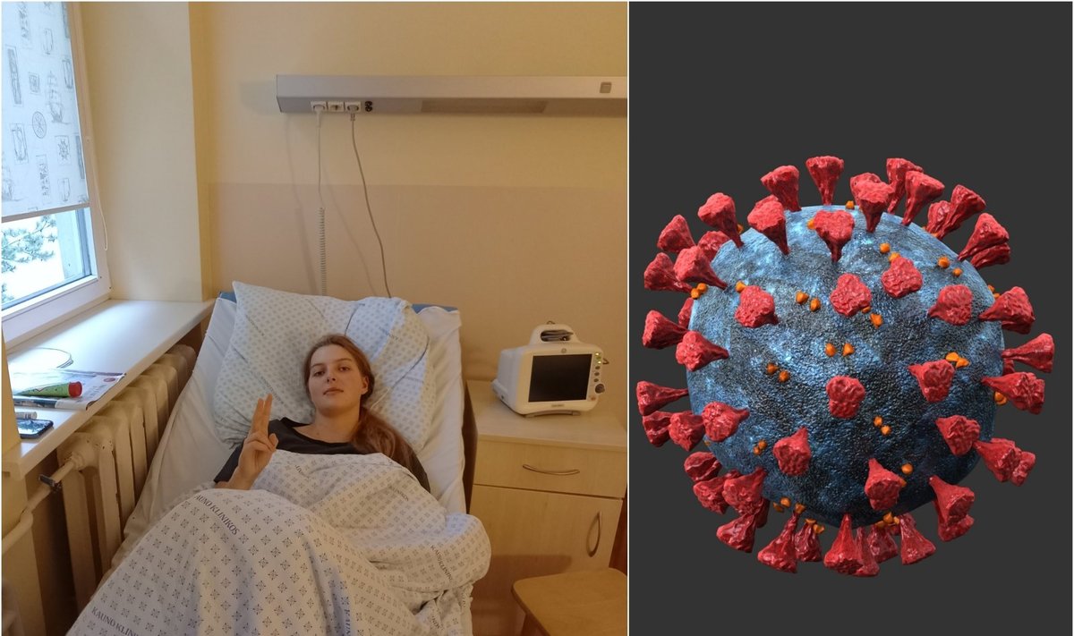 17-metė Emilija dėl COVID-19 ligos sukeltų komplikacijų atsidūrė Kauno klinikų Vaikų intensyviosios terapijos skyriuje