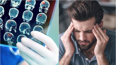 Neurologė – apie dažną ir itin varginantį skausmą: kaip atskirti, kad reikia ne tabletės, o skubios mediko pagalbos