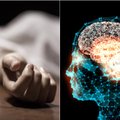 Amerikiečių mokslininkas pakeitė mirties apibrėžimą: kaip jam pavyko atgaivinti mirusias smegenis ir ką tai reiškia?