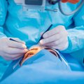 Nemokamos akių vokų plastinės operacijos – neišnaudota pacientų galimybė